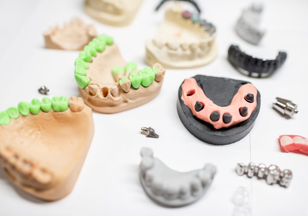 Various of artificial jaw models with dental implants and crowns on the white background. Concept of aesthetic dentistry and implantation technology