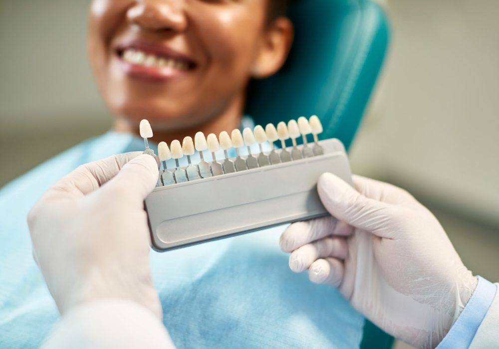 Close-up of dentist and his patient choosing the shade of dental veneers during appointment at dental clinic.